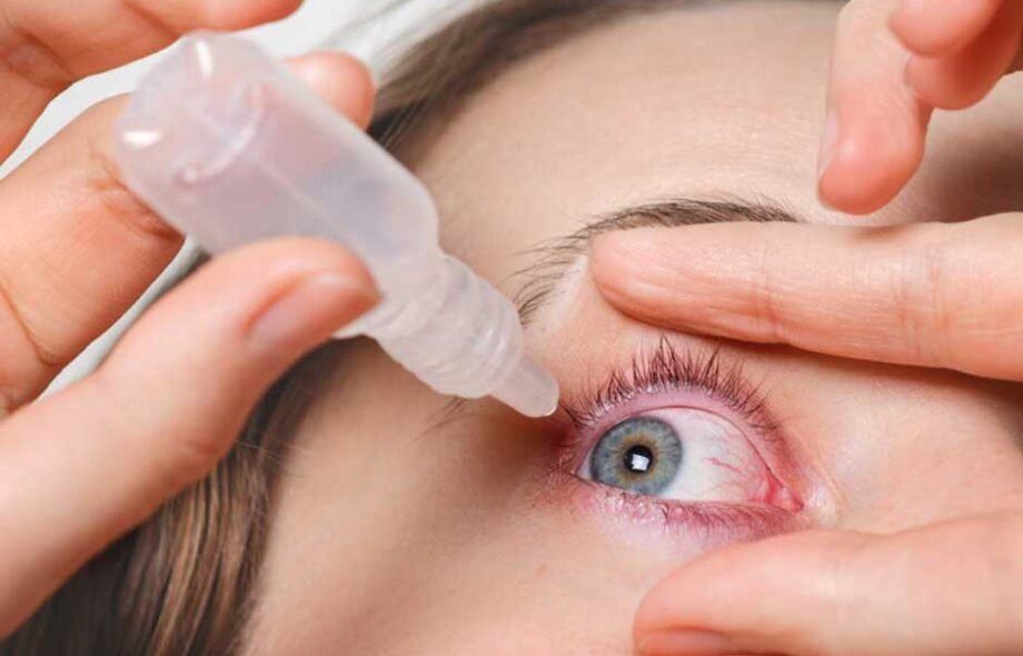 Effective Dry Eye Treatment Strategies